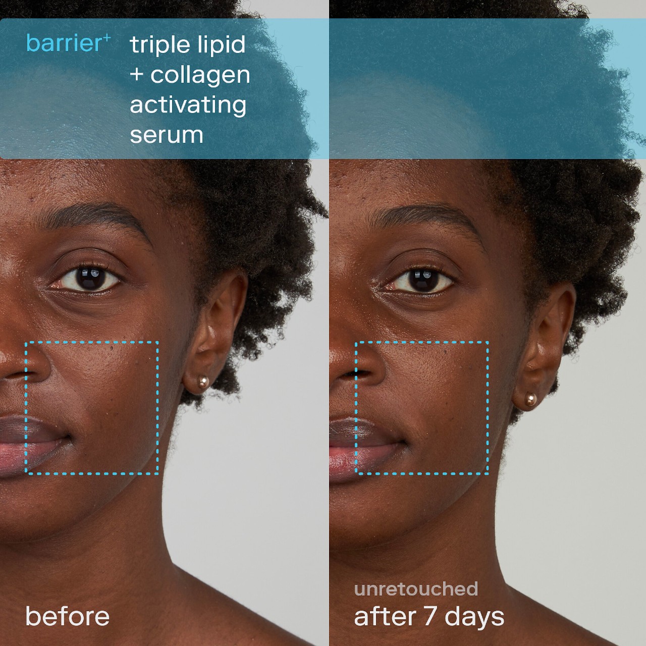 Набор для обезвоженной кожи Skinfix Better Skin Starts Here — фото 6