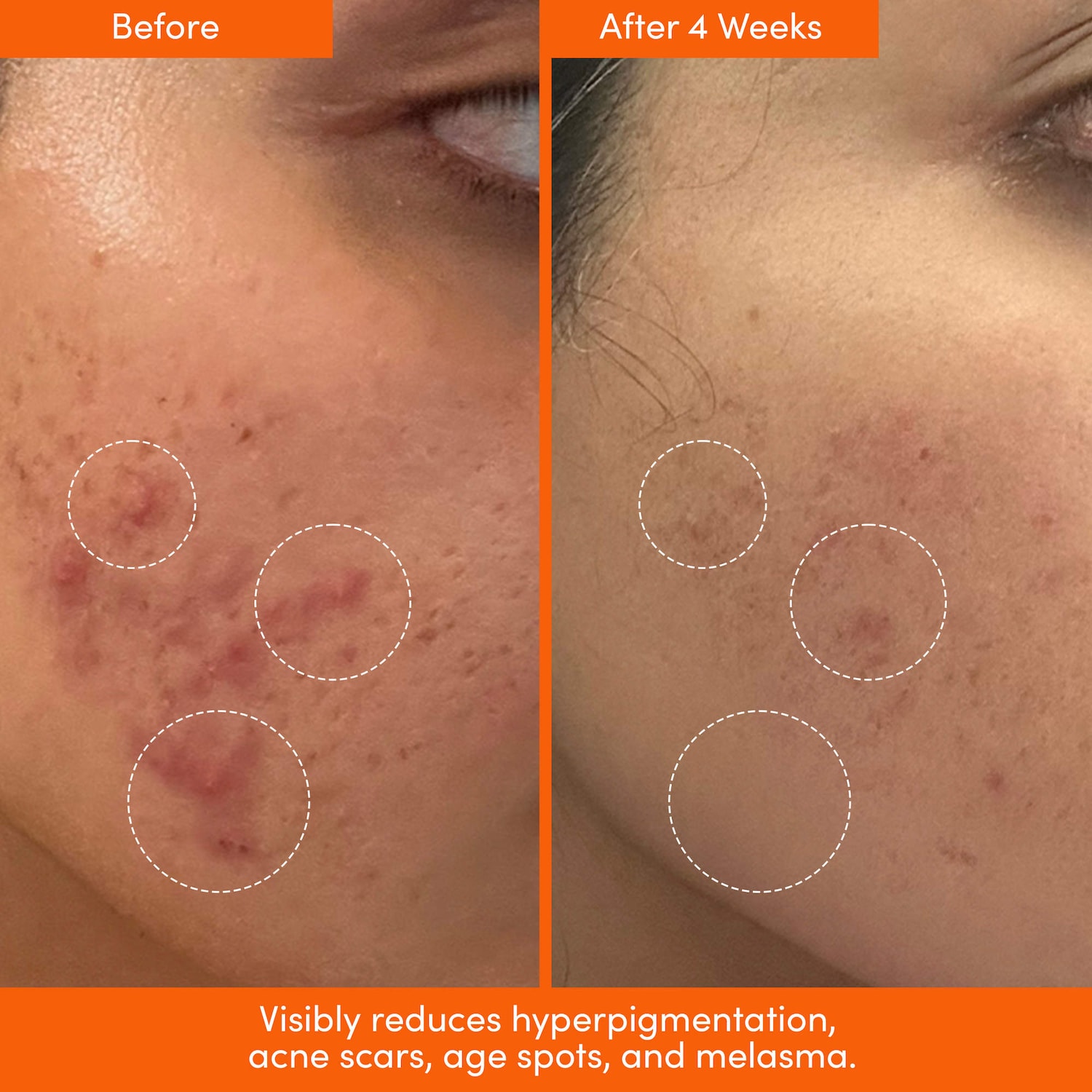 UNSPOTTED 4X Dark Spot + Hyperpigmentation AHA Serum