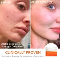 The Holiday Peel Vault