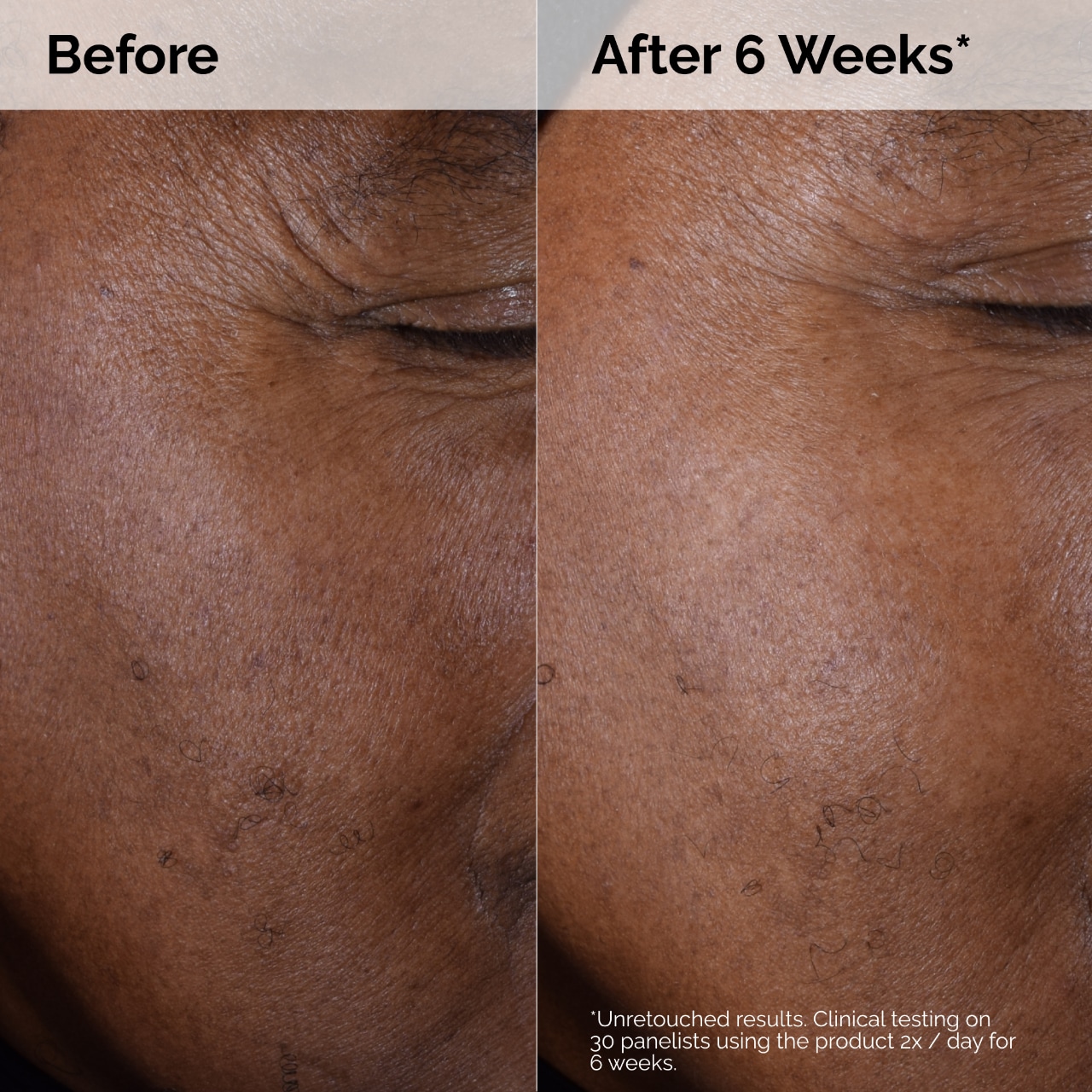 Мини-тонер для лица The Ordinary Glycolic Acid 7% отшелушивающий, для сияния — фото 7
