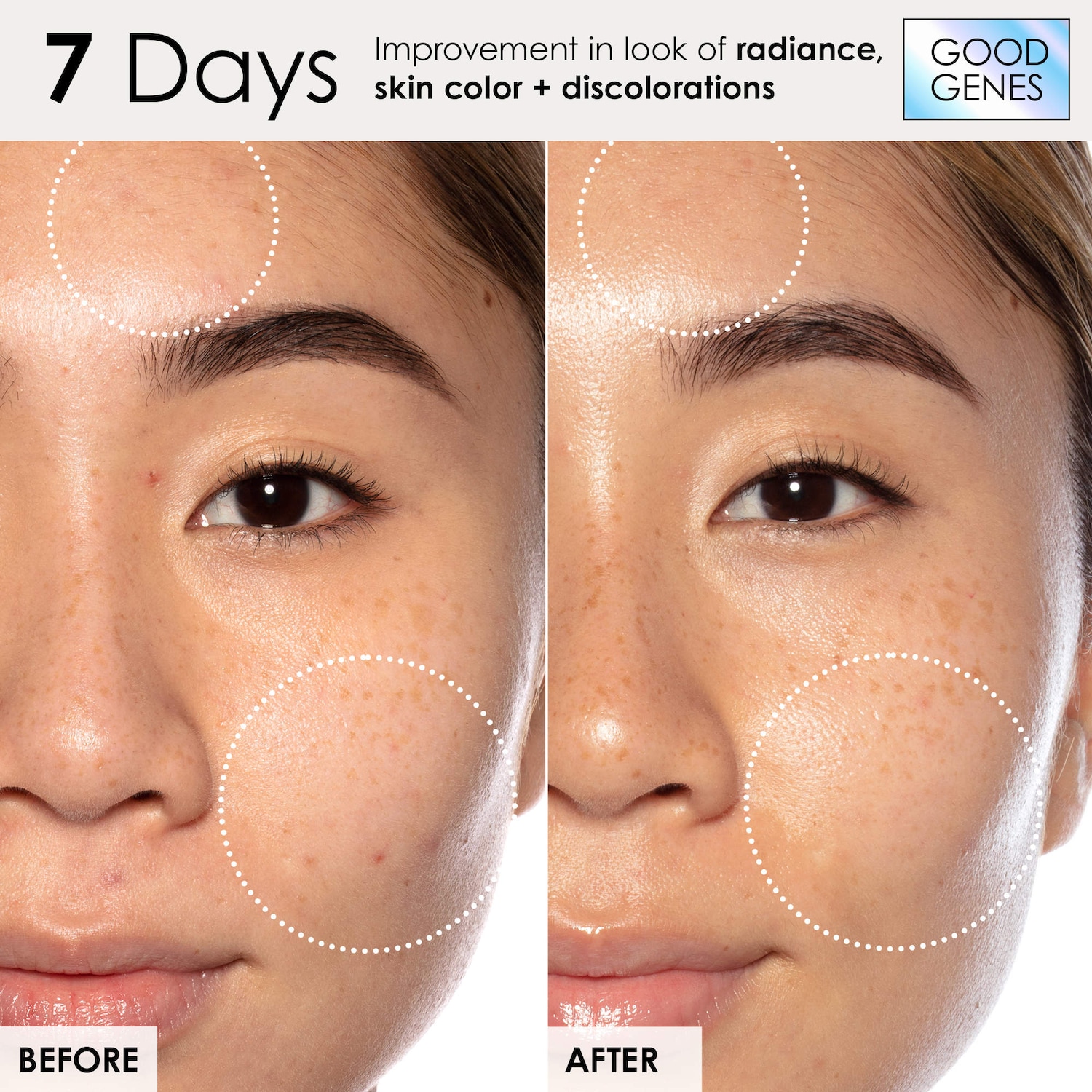 Good Genes All-In-One Lactic Acid Serum For Dark Spots And Uneven Texture