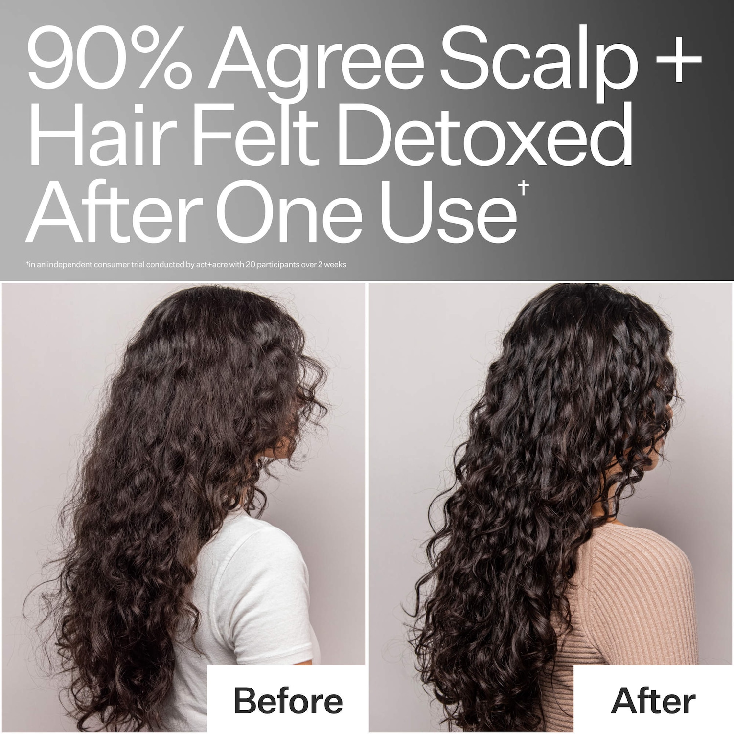 Act+Acre Scalp + Hair Treatment - Thumbnail 5