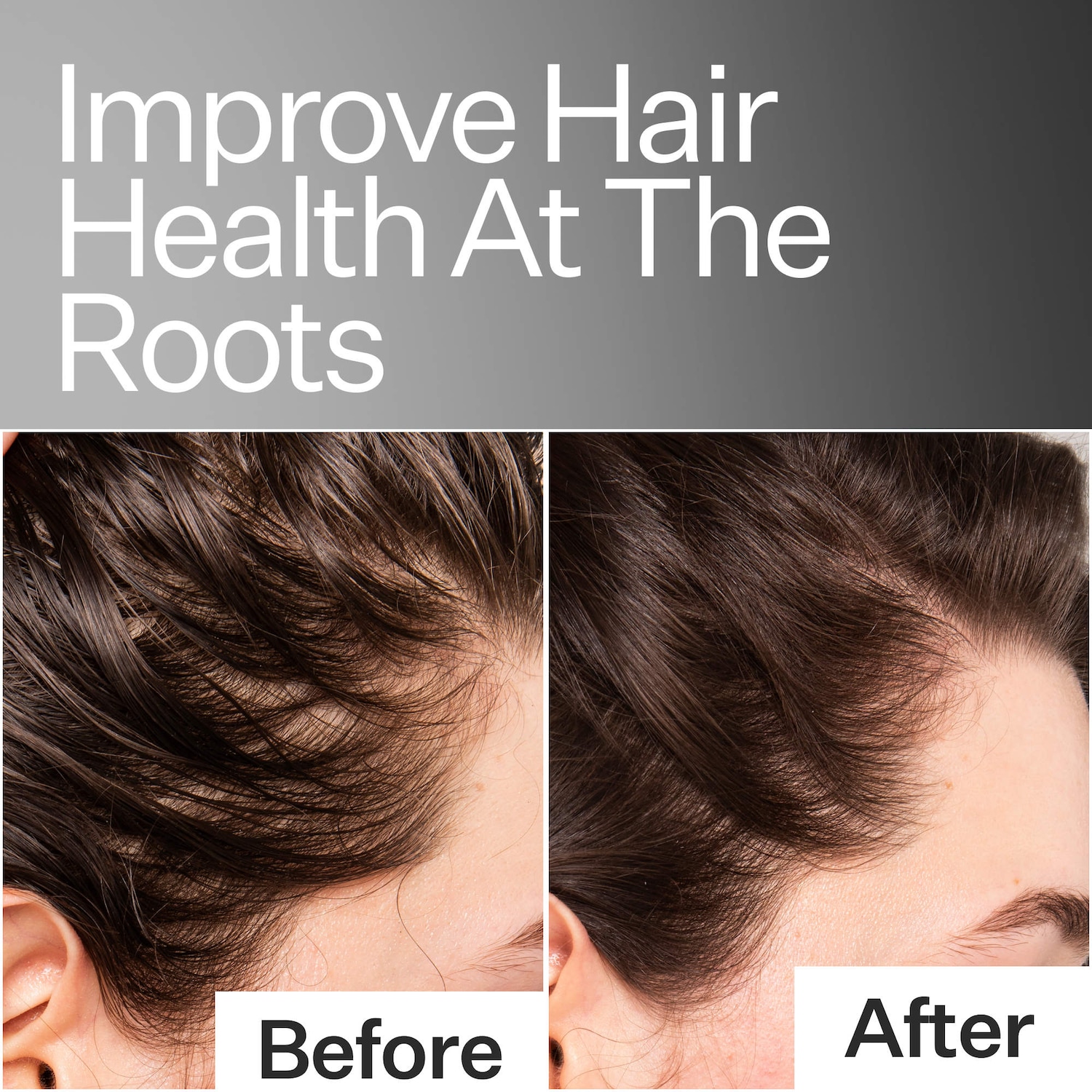 Act+Acre Scalp Relief System - Thumbnail 4