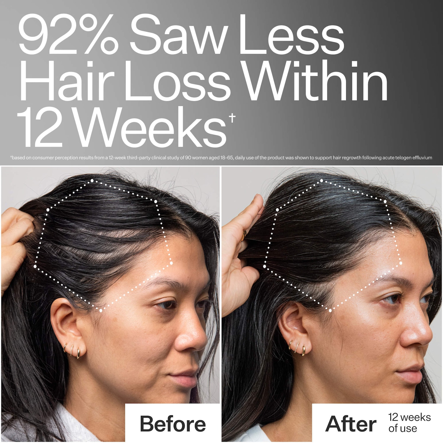 3% Stem Cell Peptide Hair + Scalp Treatment For Severe Hair
