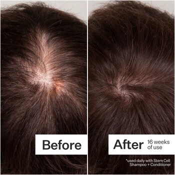 3% Stem Cell Peptide H3-Grow+ Complex™ Scalp Treatment For Thicker