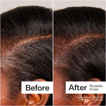 3% Stem Cell Peptide H3-Grow+ Complex™ Scalp Treatment For Thicker