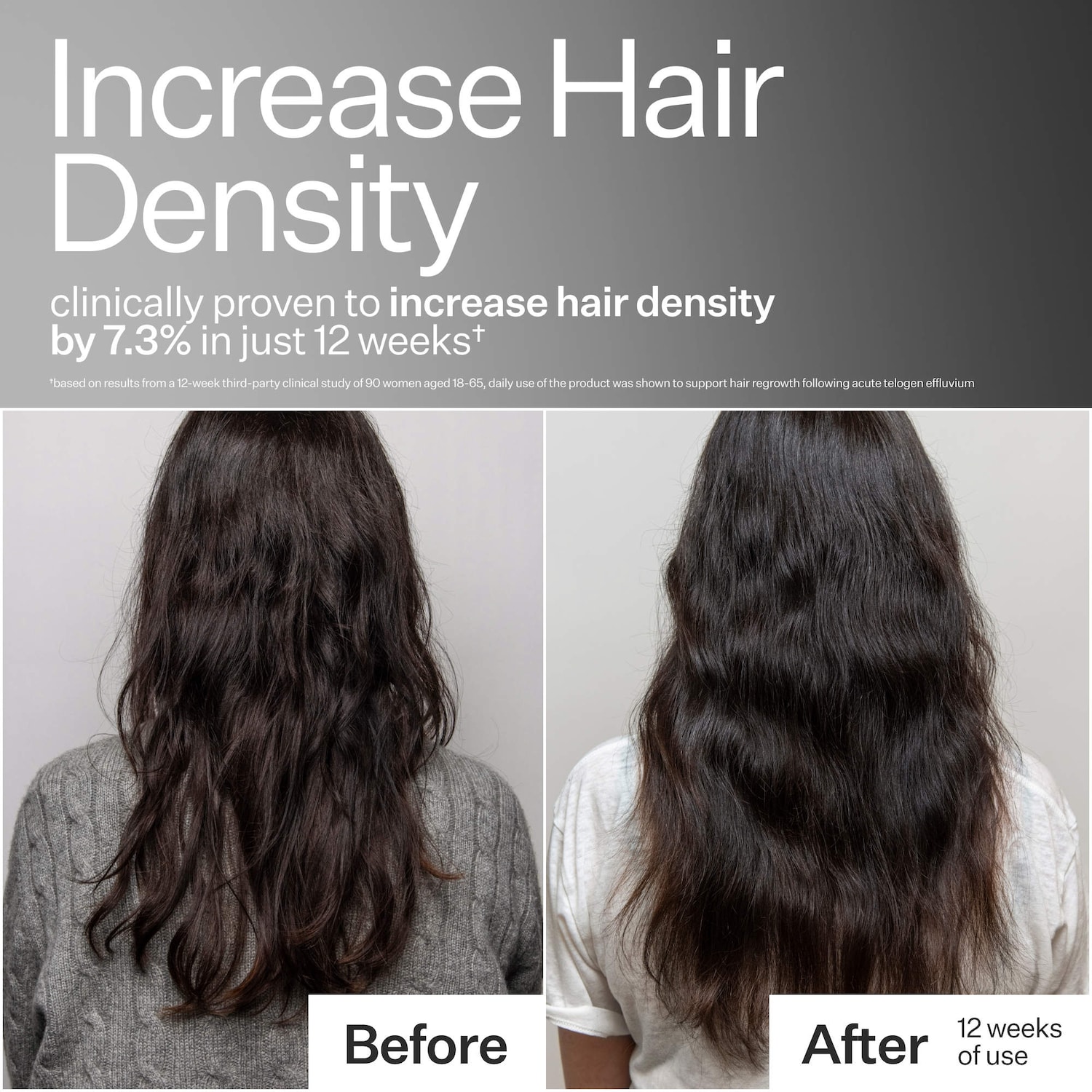3% Stem Cell Peptide Hair + Scalp Treatment For Severe Hair Thinning
