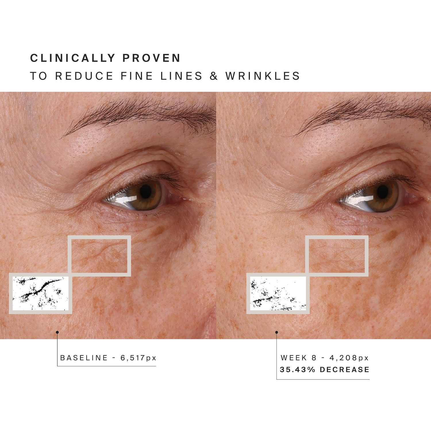 Red Light Face Mask for Fine Lines & Glowing Skin