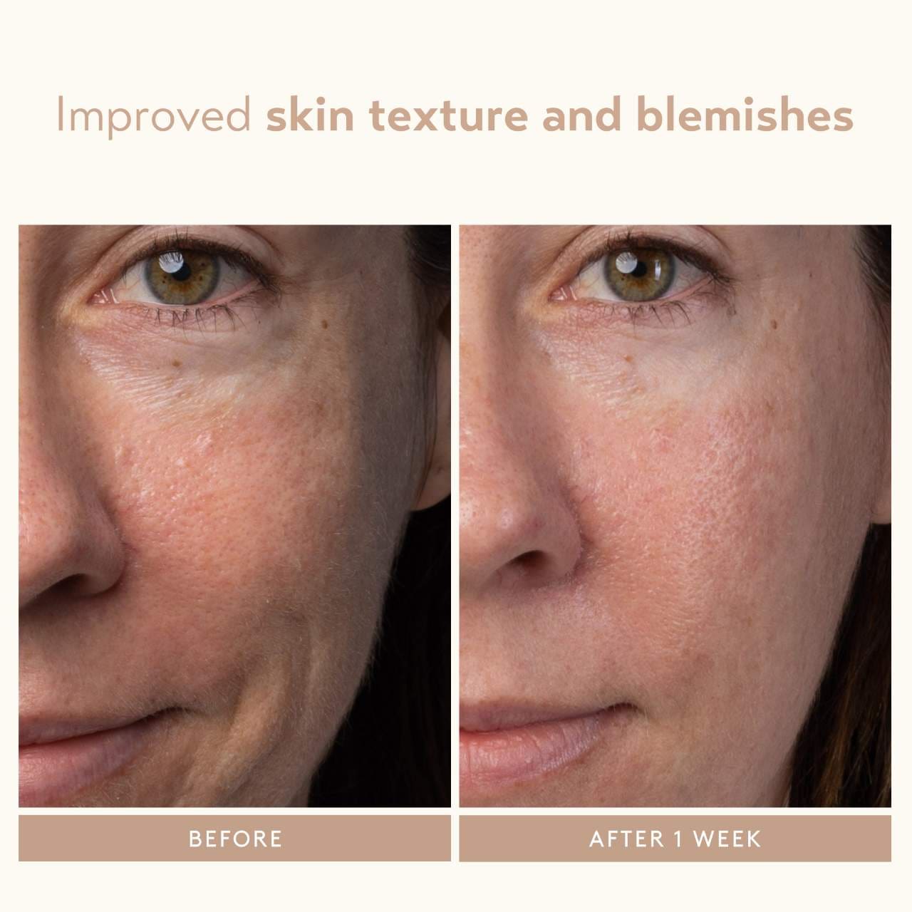 Отшелушивающая сыворотка с молочной кислотой и AHA Shani Darden Skin Care — фото 5