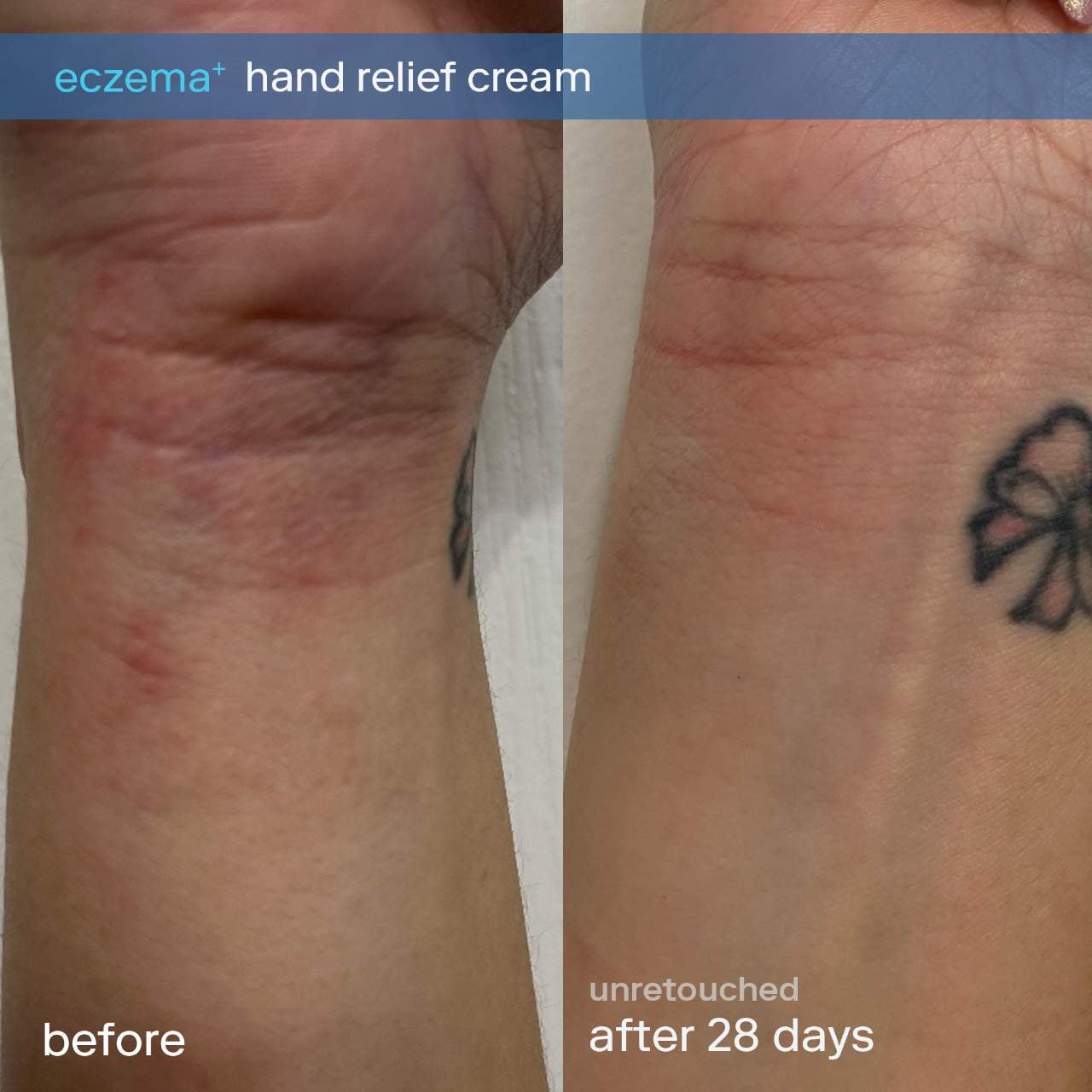 Крем для рук и ног Skinfix Eczema+ с церамидами — фото 2