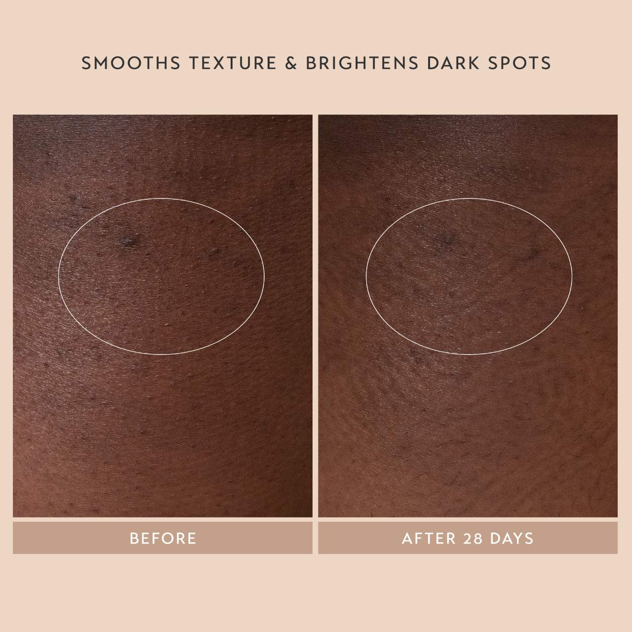 Shani Darden Skin Care Сыворотка Shani Darden Body Reform с ретиноидом — фото 2