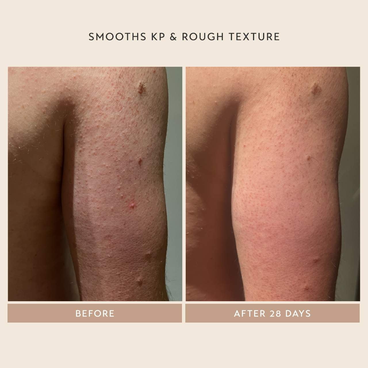 Shani Darden Skin Care Сыворотка Shani Darden Body Reform с ретиноидом — фото 3