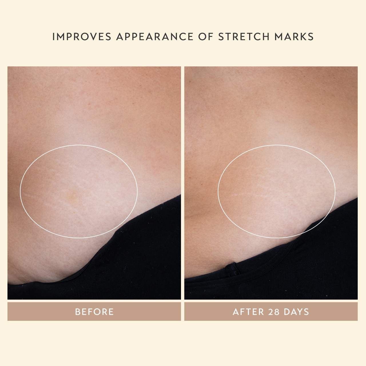 Shani Darden Skin Care Сыворотка Shani Darden Body Reform с ретиноидом — фото 4