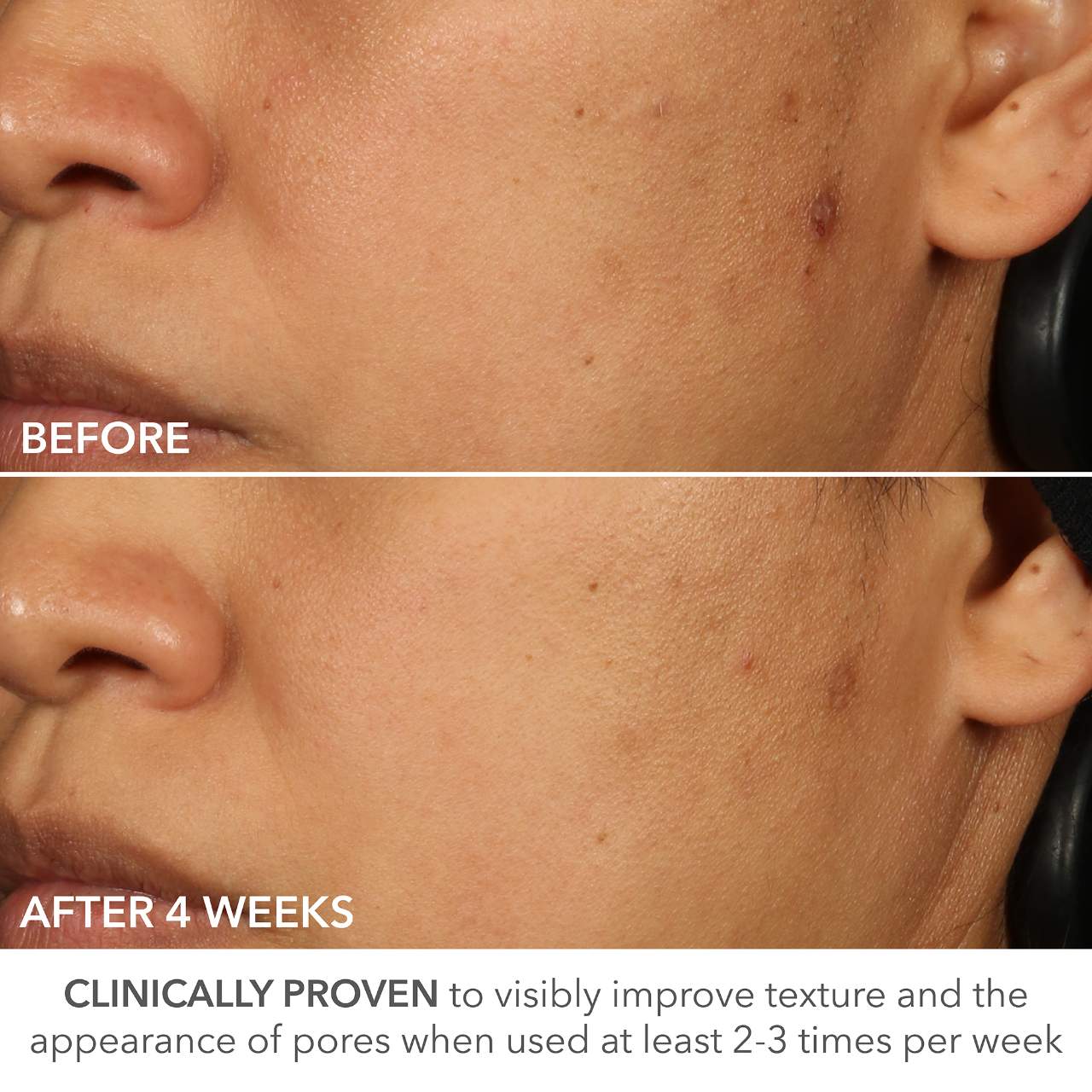 Ретинол усиленной силы 0.5% Dr. Dennis Gross Skincare Advanced Retinol + Ferulic — фото 7