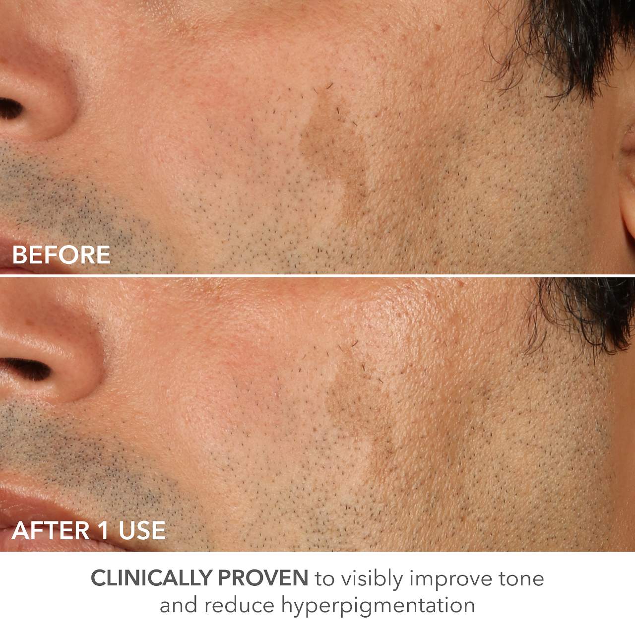 Ретинол усиленной силы 0.5% Dr. Dennis Gross Skincare Advanced Retinol + Ferulic — фото 8