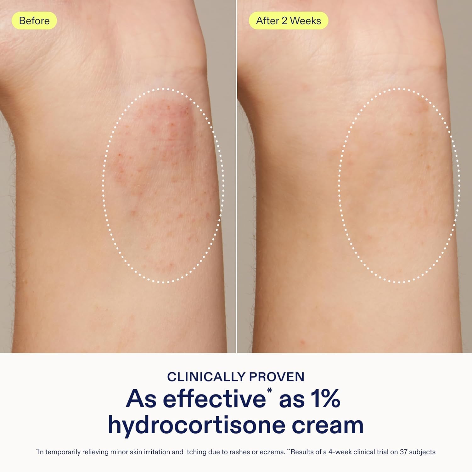 eczema+ Dermatitis Ceramide Face + Body Cream - Skinfix | Sephora