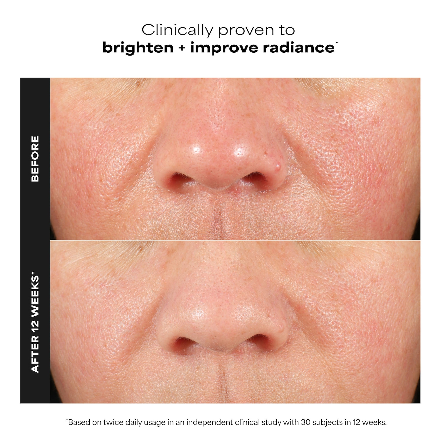 C15 Super Booster for Brightening Dullness & Uneven Tone