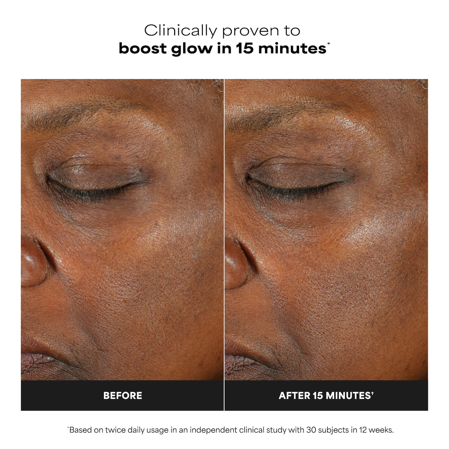 C15 Super Booster for Brightening Dullness & Uneven Tone