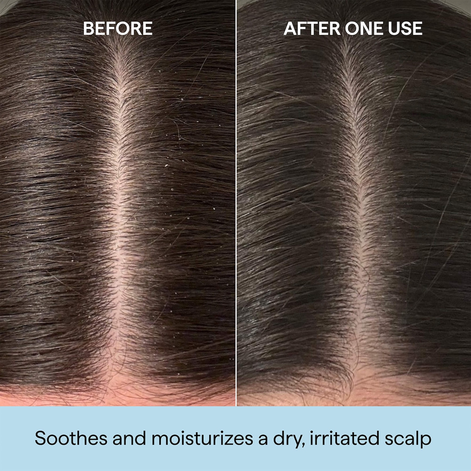 Briogeo Scalp Revival Scalp and Hair Oil - Thumbnail 2