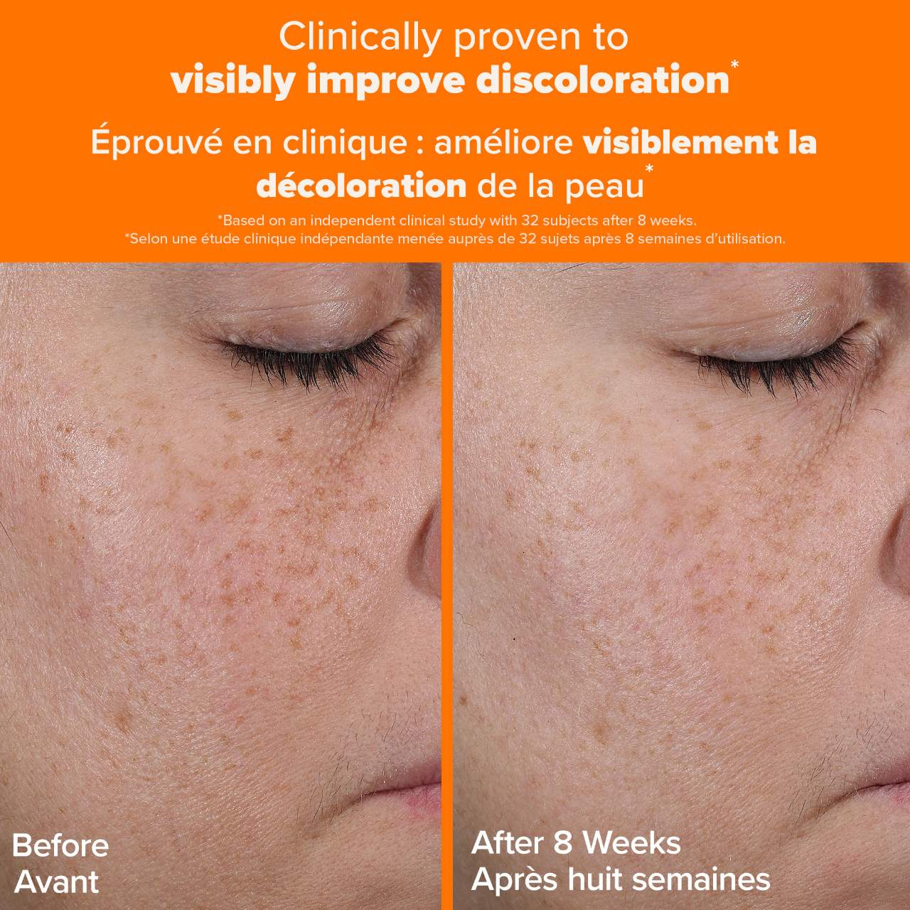 25% Vitamin C + Glutathione Clinical Serum for Brightening and