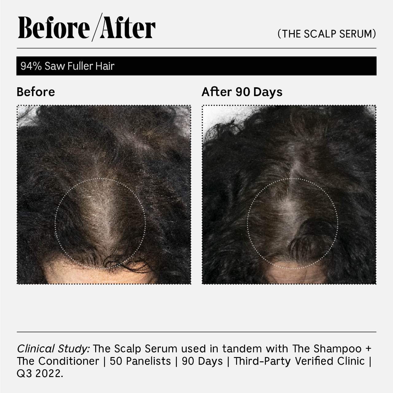 Сыворотка для кожи головы с 5% Capixyl для густоты волос Nécessaire The Scalp Serum — фото 4