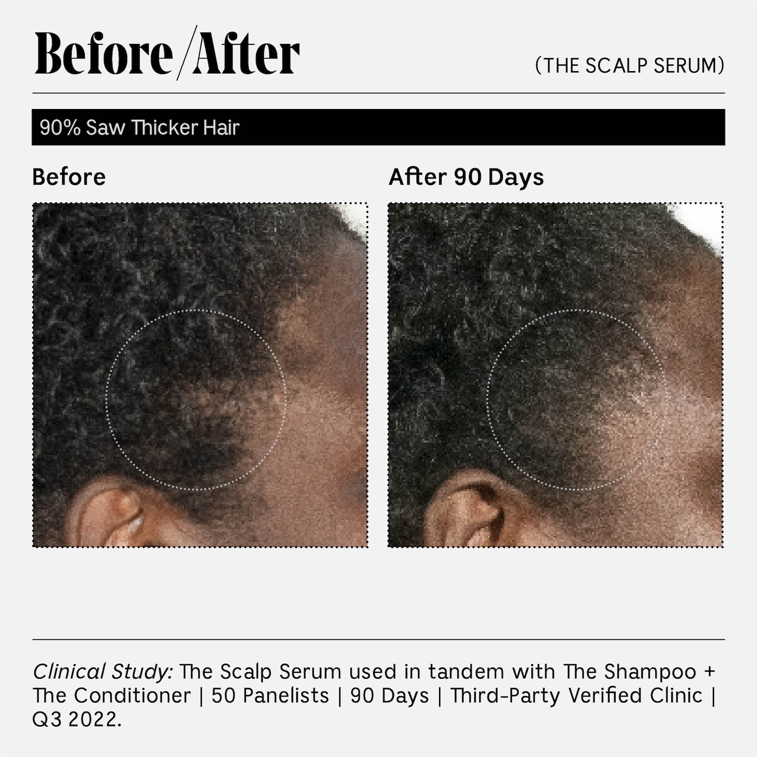 Сыворотка для кожи головы с 5% Capixyl для густоты волос Nécessaire The Scalp Serum — фото 5
