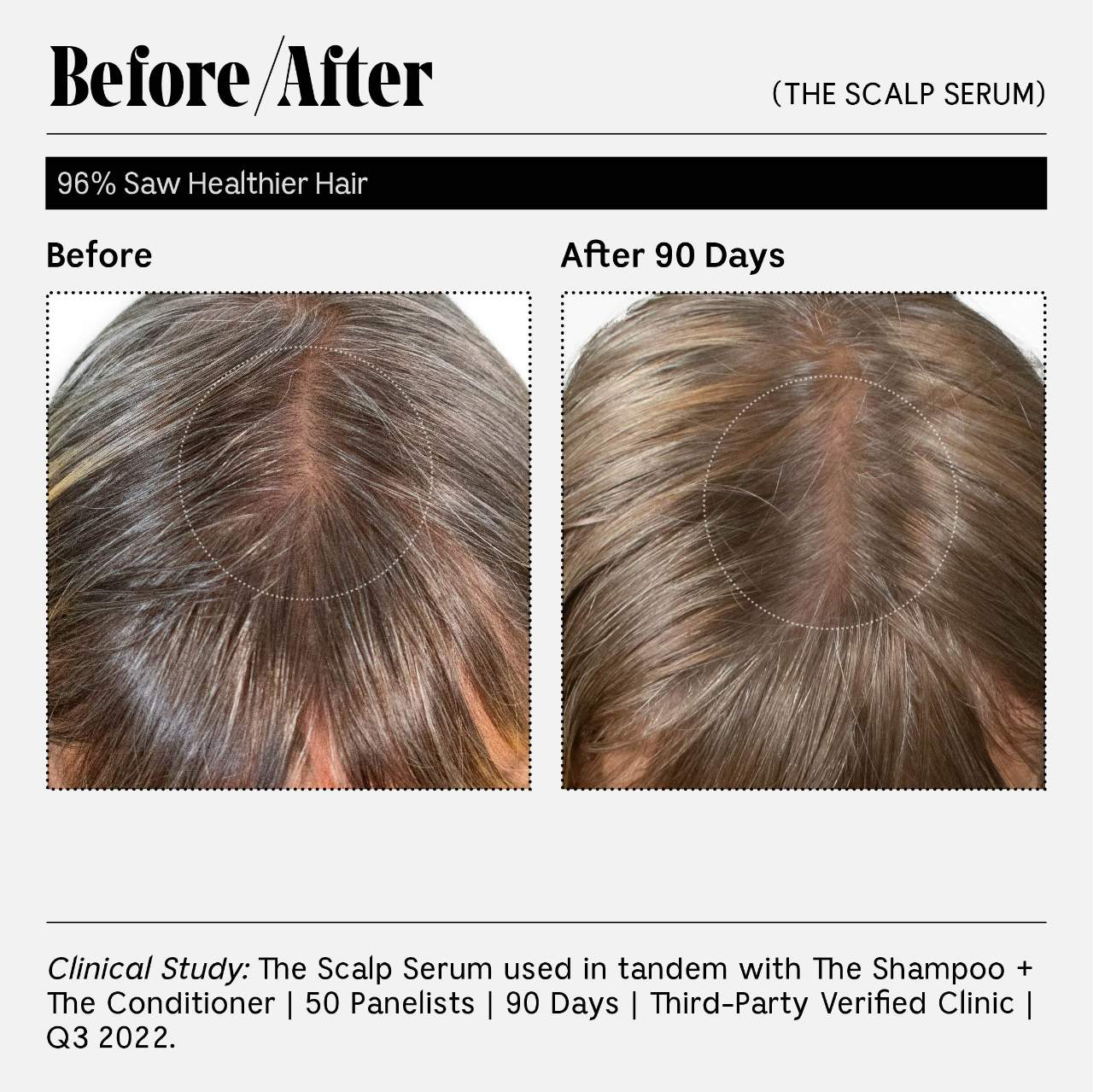 Сыворотка для кожи головы с 5% Capixyl для густоты волос Nécessaire The Scalp Serum — фото 6