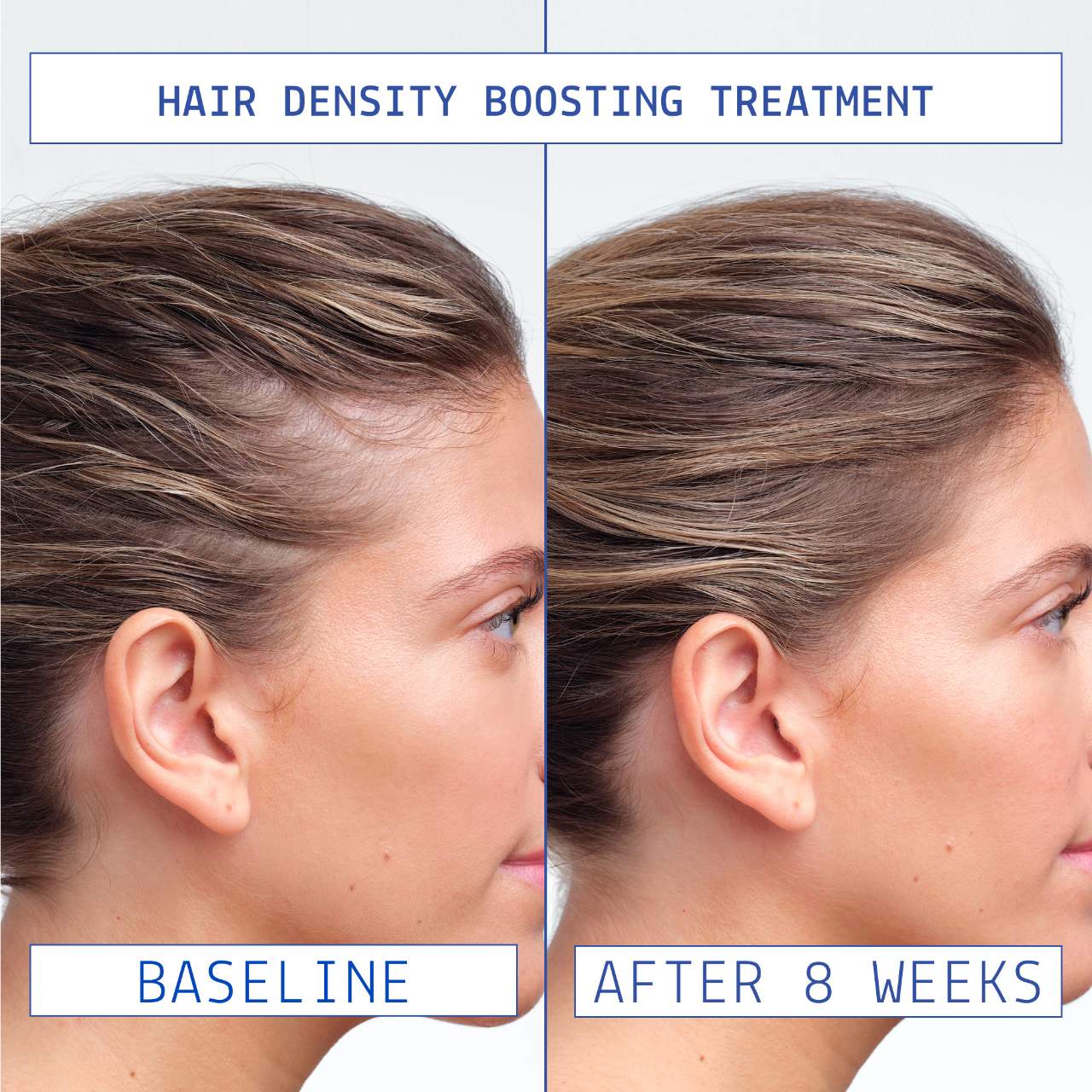 AAVRANI Hair Oil & Serum - Thumbnail 2