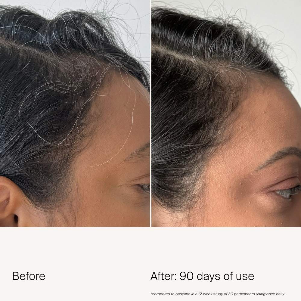 Сыворотка для плотности редеющих и седеющих волос Living Proof Scalp Care — фото 2