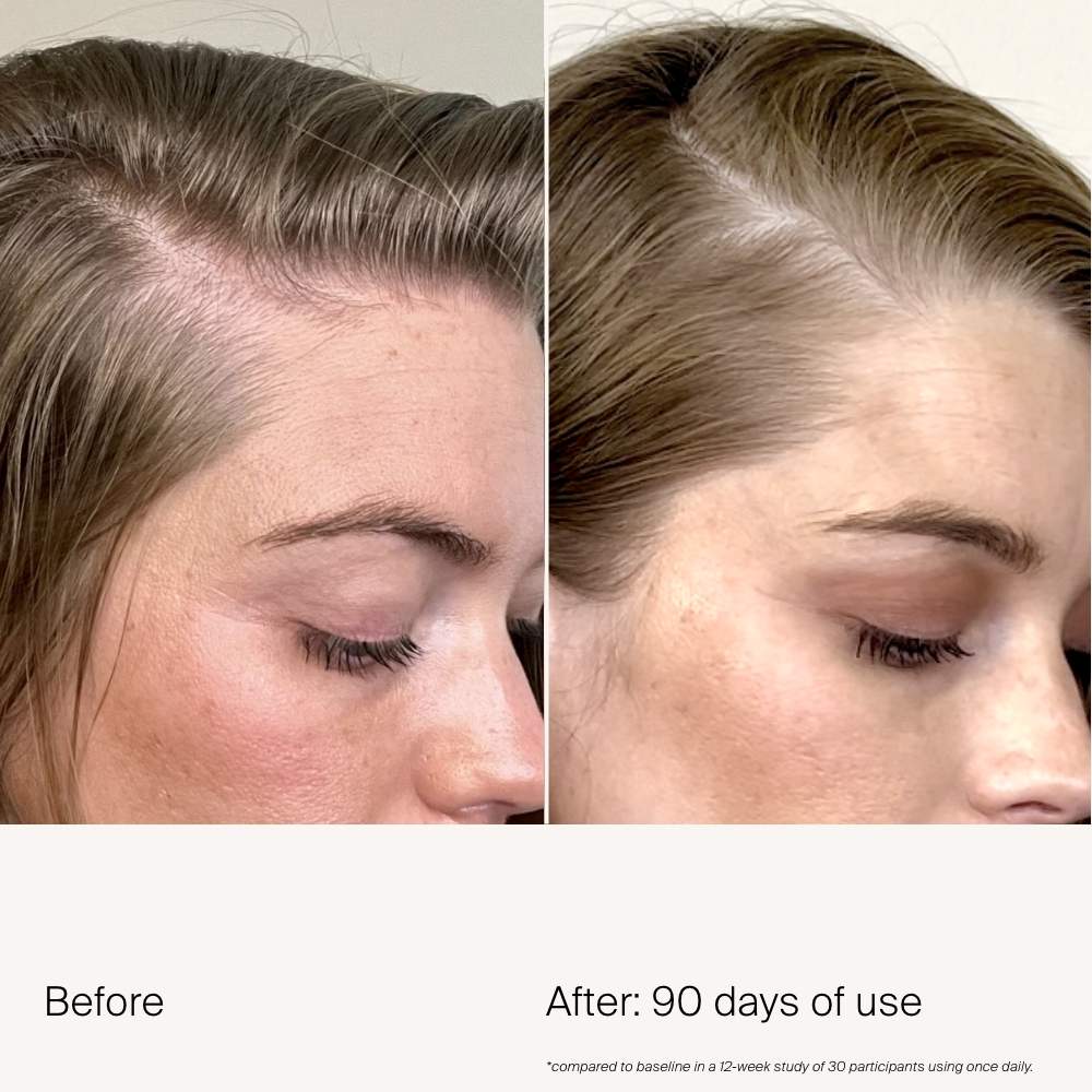 Сыворотка для плотности редеющих и седеющих волос Living Proof Scalp Care — фото 3