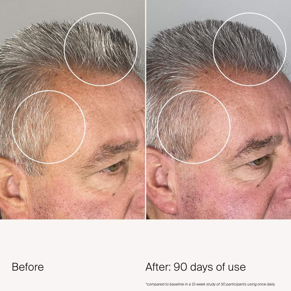 Living Proof Scalp Care Density Serum - Thumbnail 4