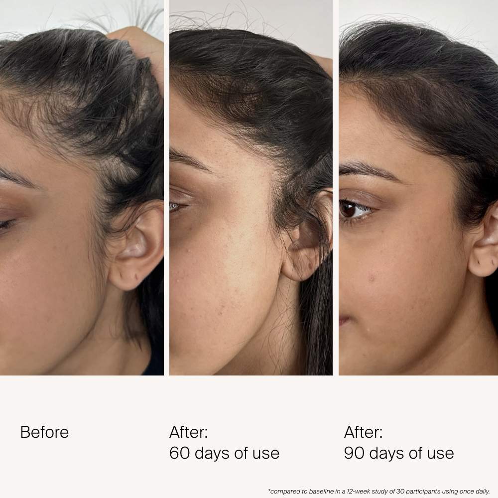 Living Proof Scalp Care Density Serum - Thumbnail 5