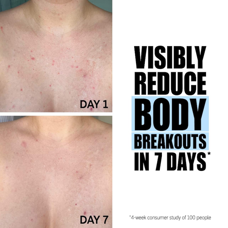 Glycolic Acid Exfoliating Body Stick thumbnail 4