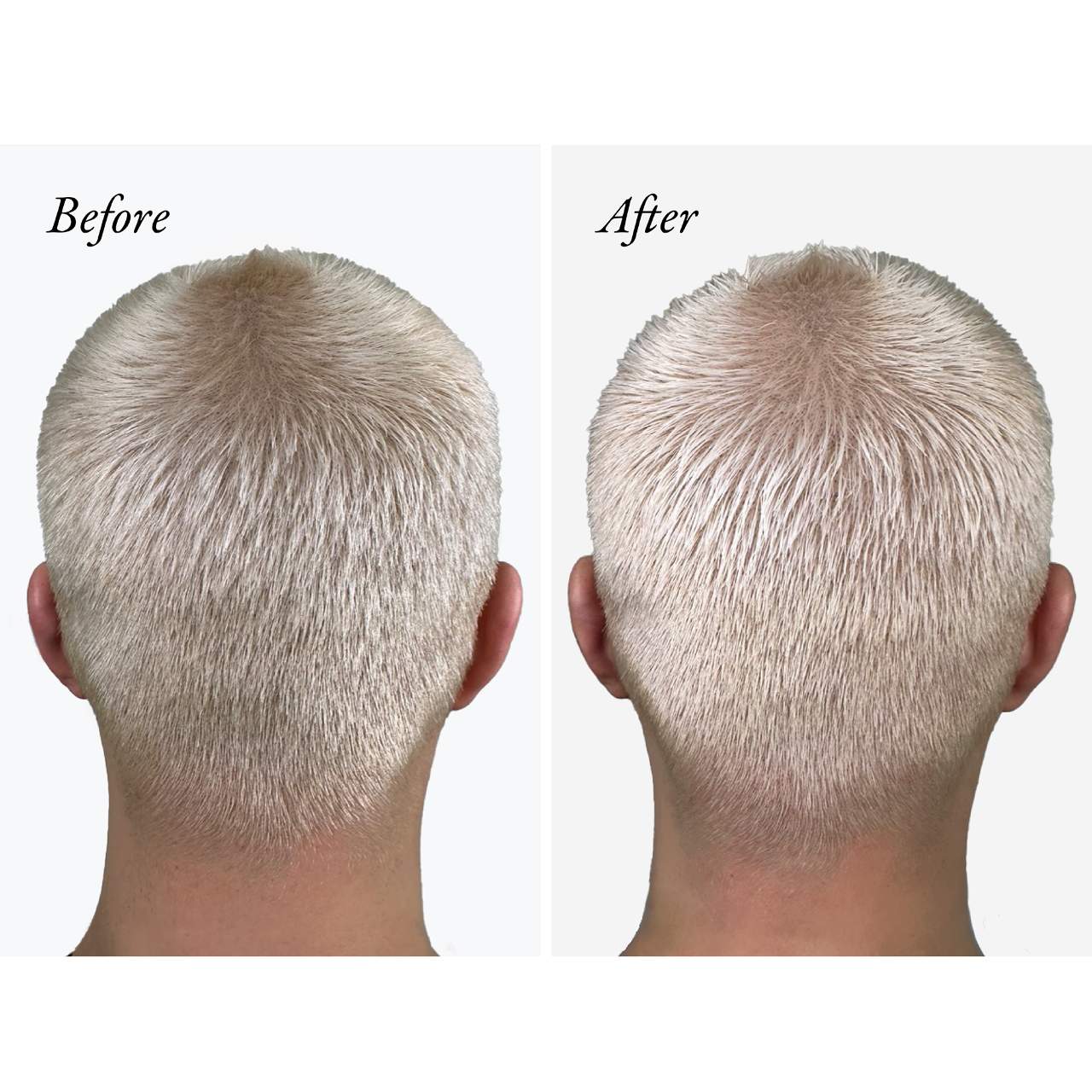 Oribe Bright Blonde Hair Treatment - Thumbnail 5