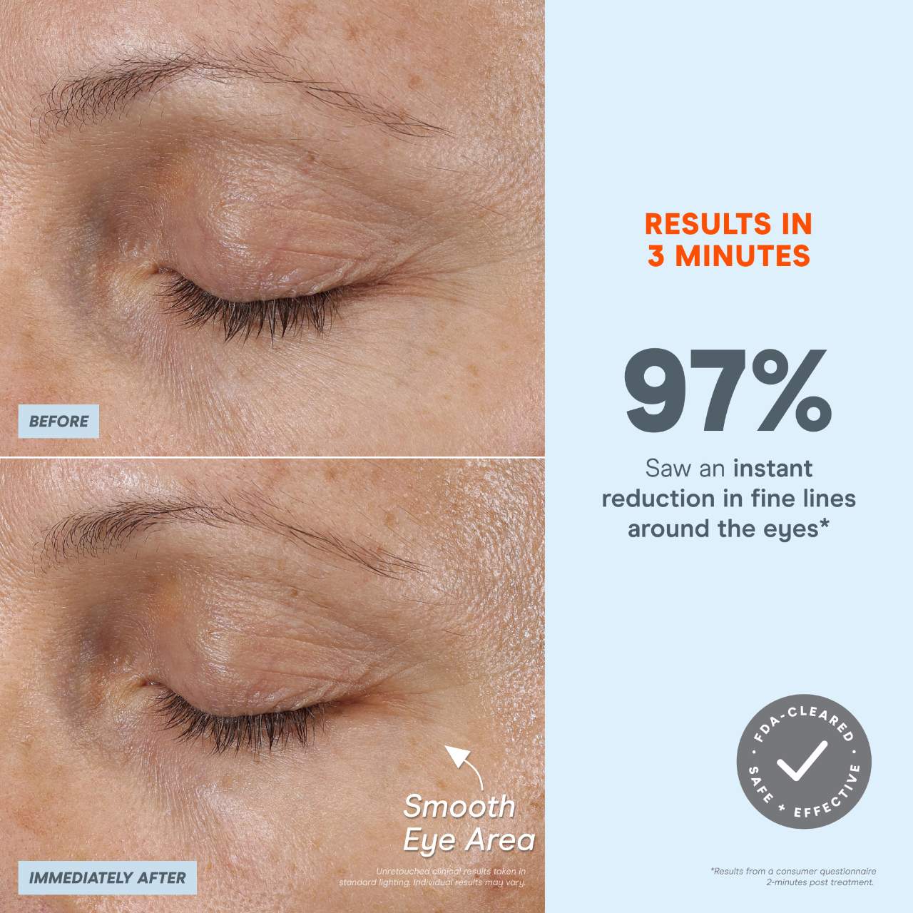 Микротоковое устройство NuFACE Fix MicroWand — фото 3