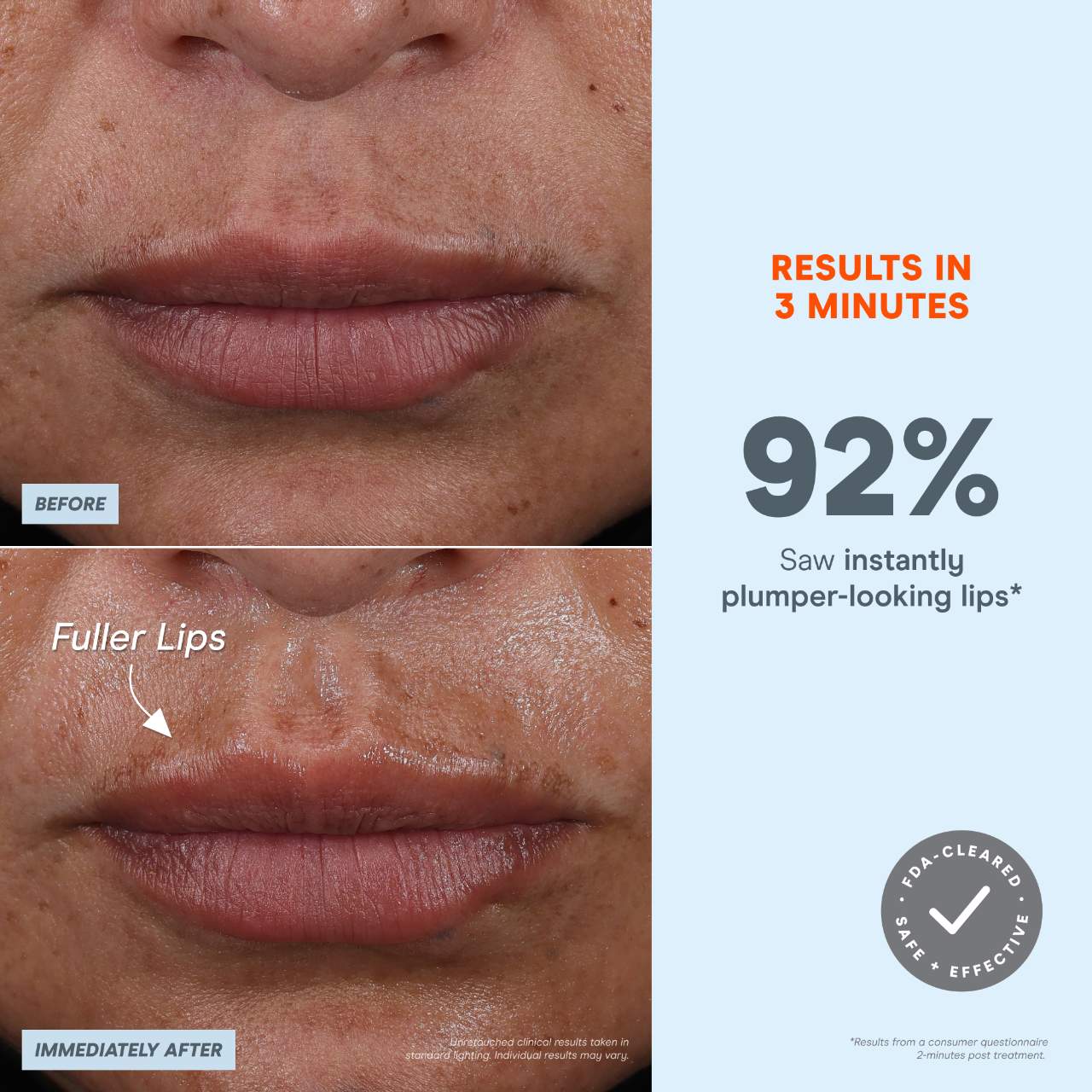 Микротоковое устройство NuFACE Fix MicroWand — фото 4