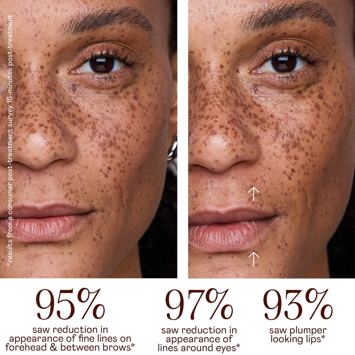 NUFACE® FIX MicroWand Microcurrent Device - NuFACE | Sephora