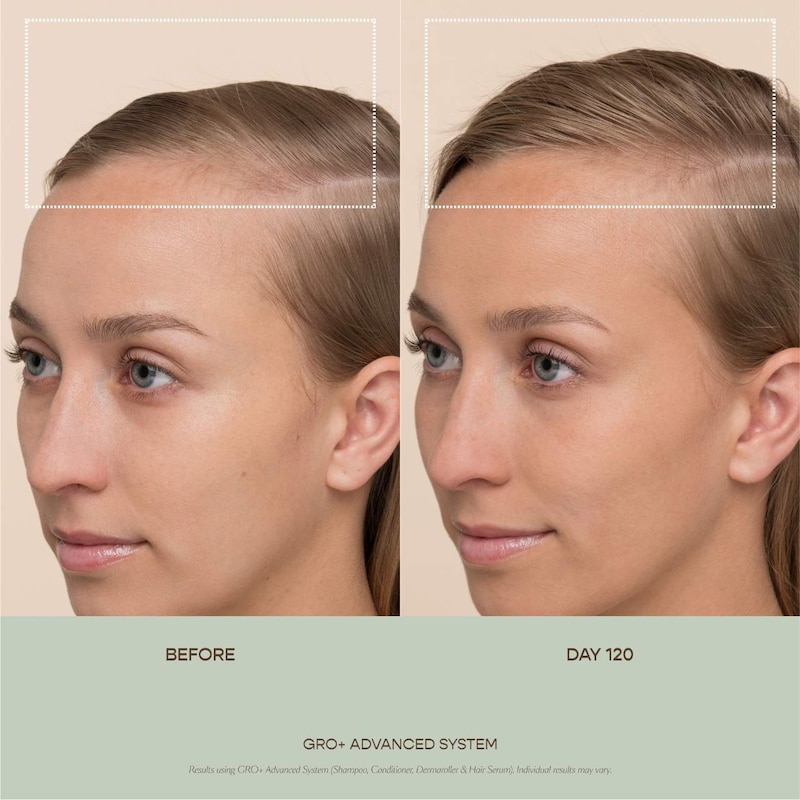 GRO+ Advanced Balancing Shampoo and Conditioner Set for Severe Signs of Thinning thumbnail 4