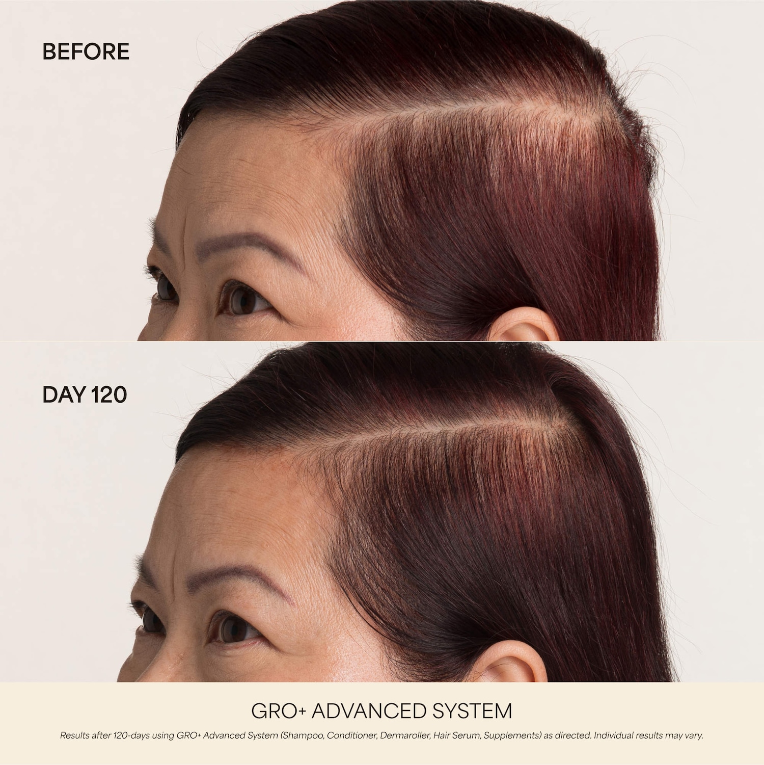 GRO+ Advanced Hair Serum Trio Set for Thinning Hair for Thinning
