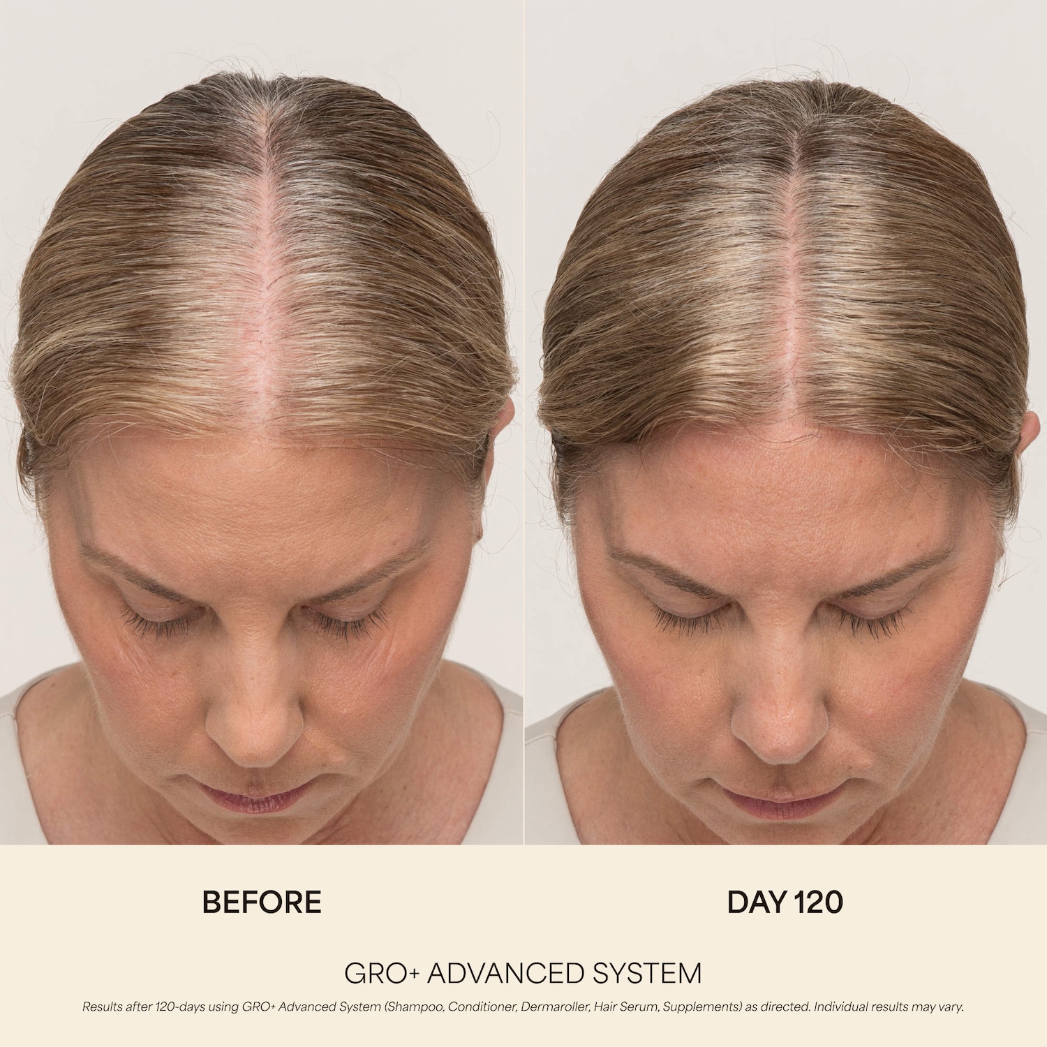 GRO+ Advanced Hair Serum Trio Set for Thinning Hair for Thinning