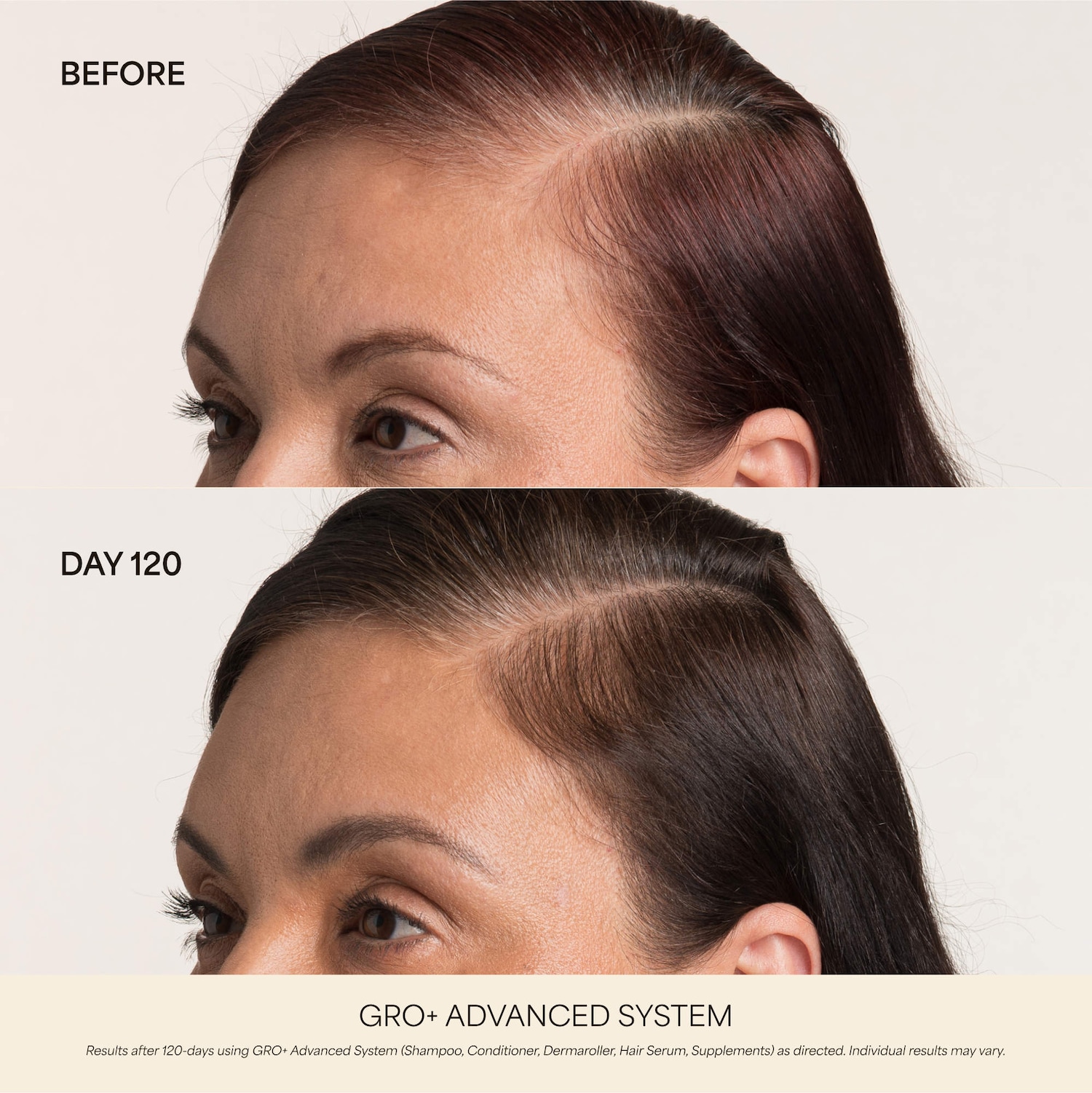 GRO+ Advanced Hair Serum Trio Set for Thinning Hair for Thinning