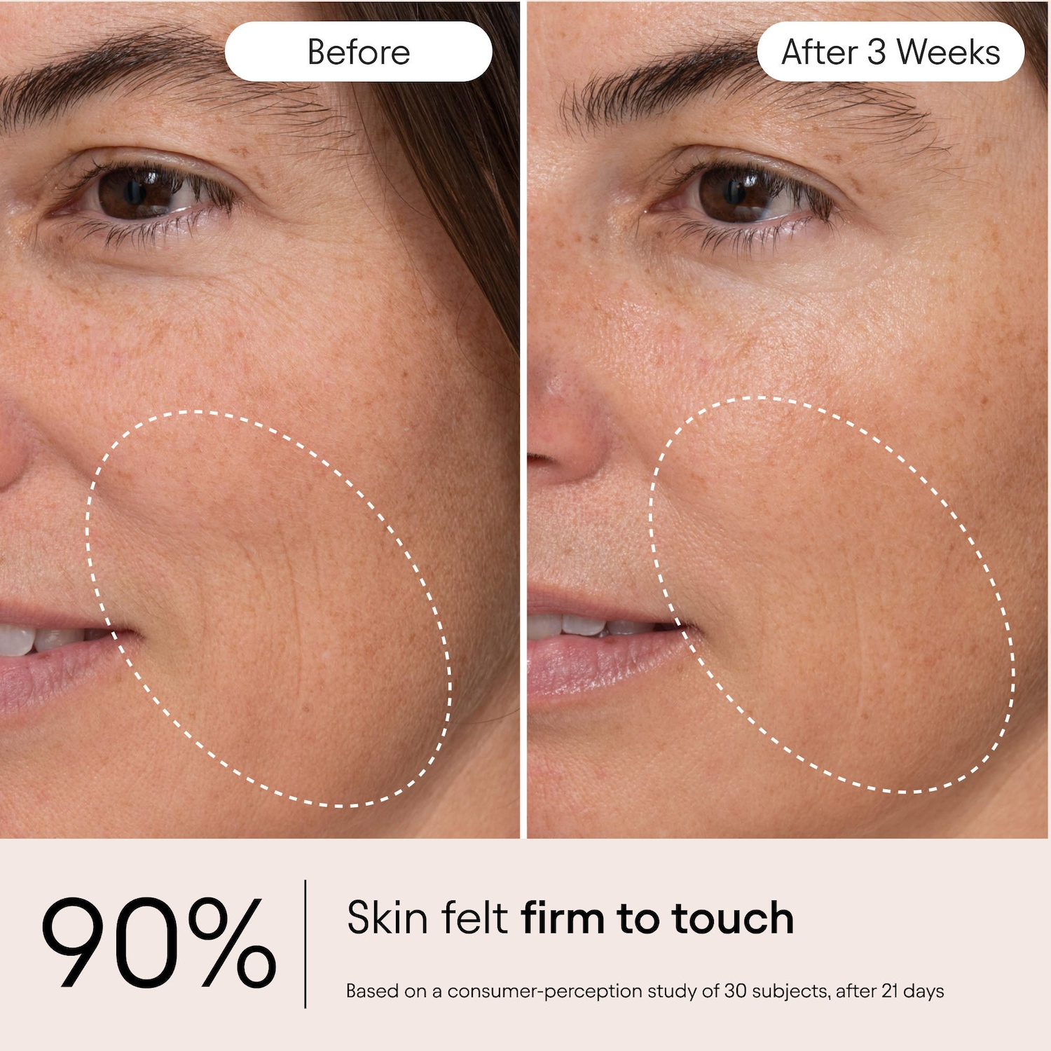 Hydrating Firming Serum with Niacinamide & Nettle