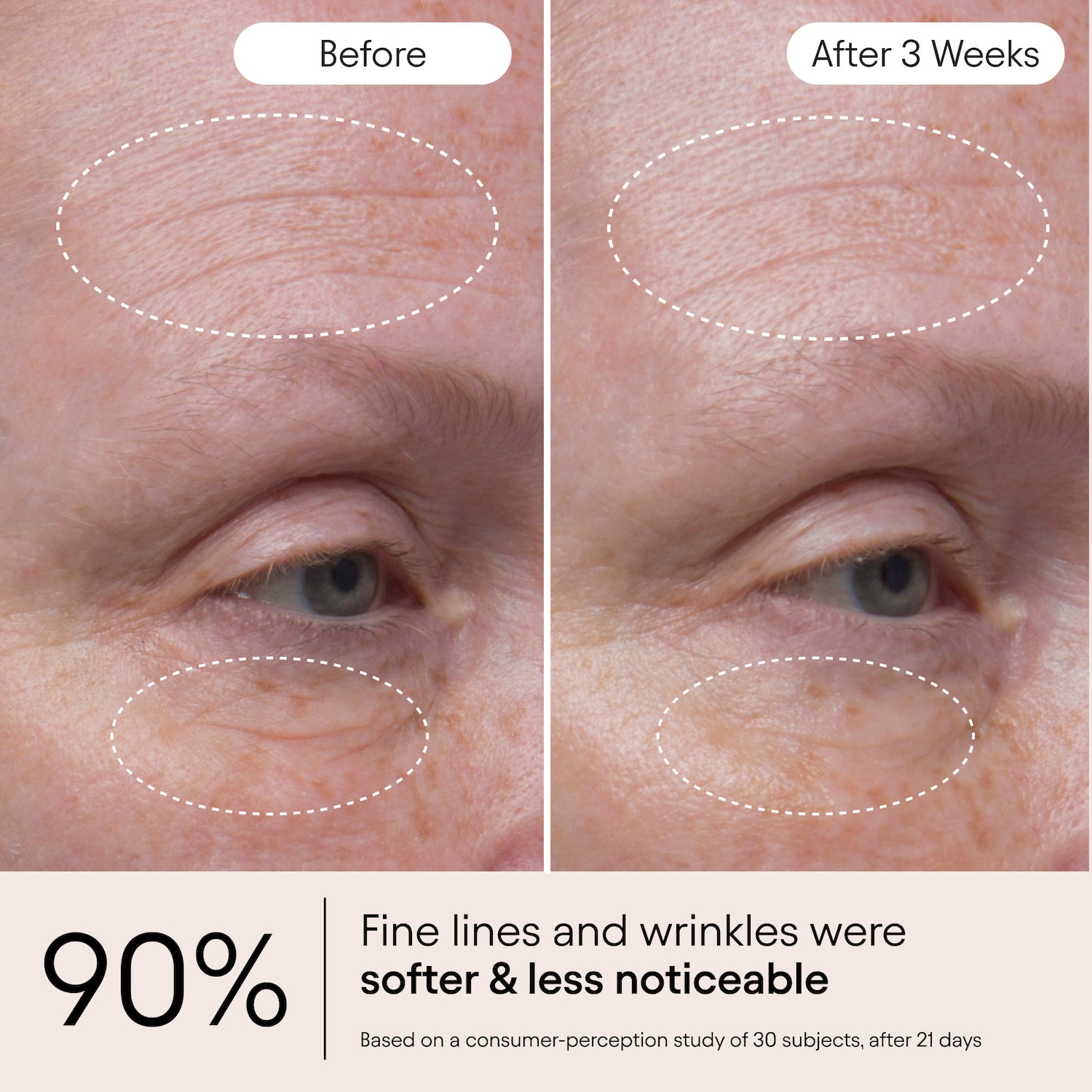 Hydrating Firming Serum with Niacinamide & Nettle