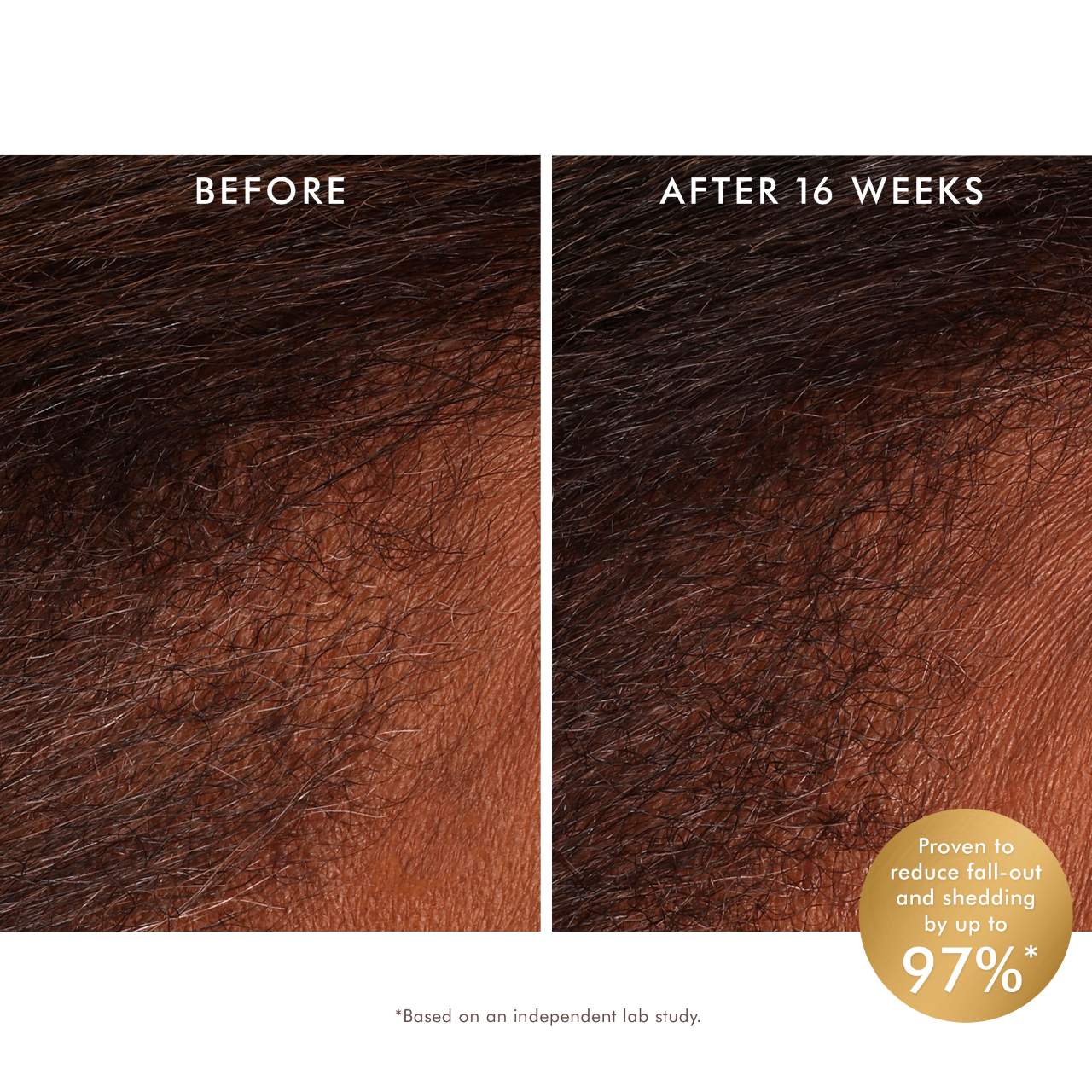 Moroccanoil Scalp Tonic - Thumbnail 4