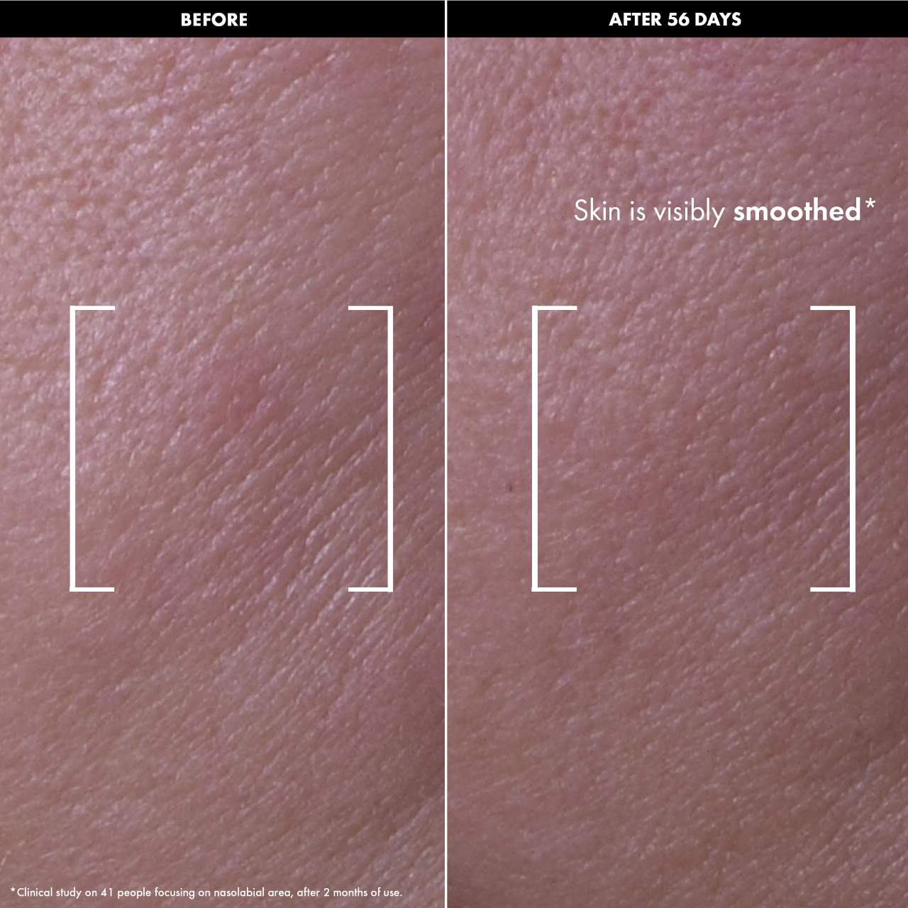 Lift & Firm - Recovery Firming Night Oil with Retinol 3