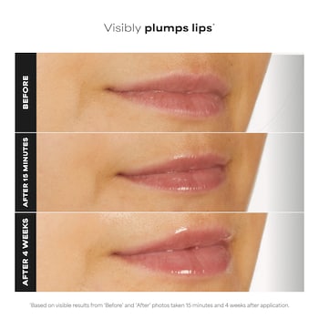 glutathione lip balm before and after results DERMDOC Smooth & Even Duo | LipBright Treatment 1% + 2.5% Arbutin (10gm) & 15% Glycolic Acid & 4% Lactic Acid InstaPedi Foot Peeling Mask (40gm) Pro-Collagen Peptide Plumping Gloss Balm