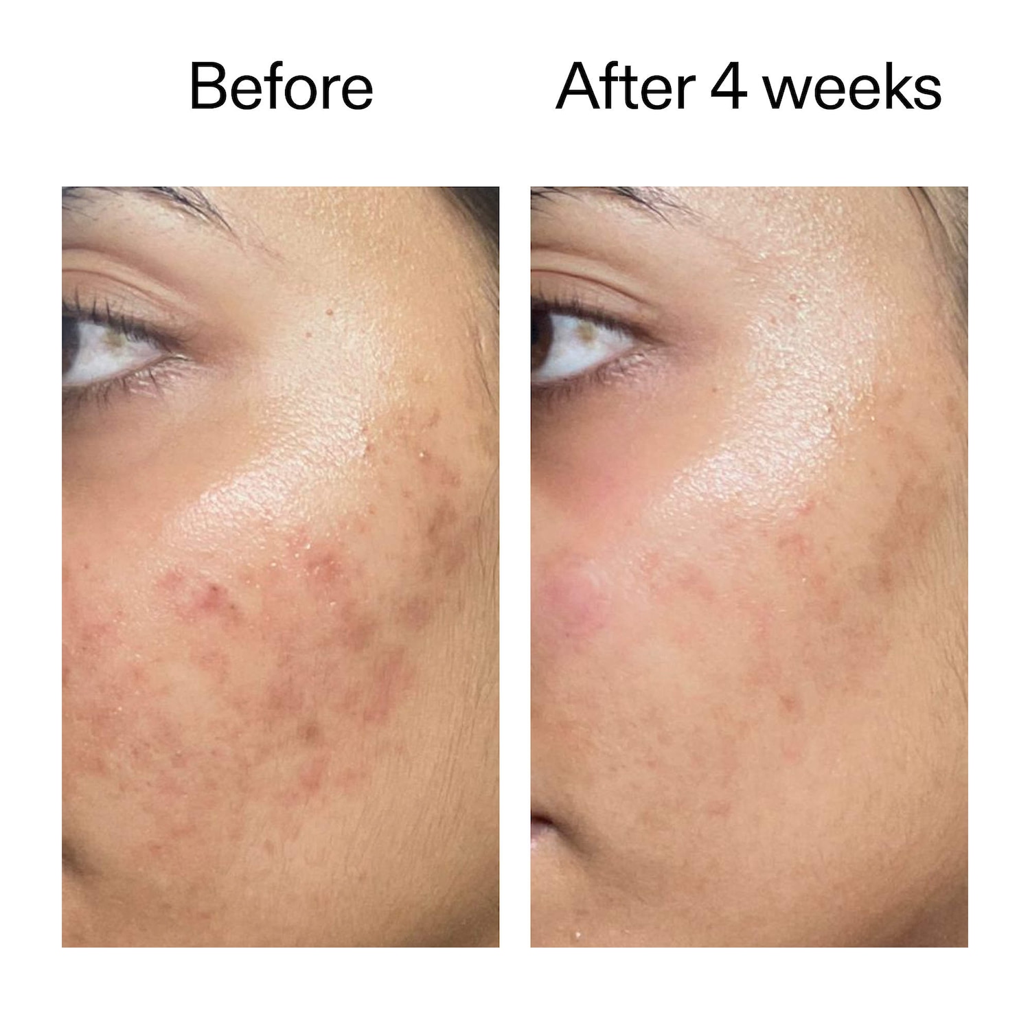 Ectoin Hydro-Barrier Serum - The INKEY List | Sephora