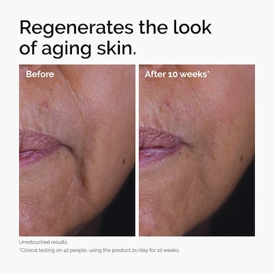 The Ordinary - GF 15% Serum for Visible Skin Repair and Wrinkles 1 oz / 30 mL The Ordinary GF 15% Serum for Visible Skin Repair and Wrinkles