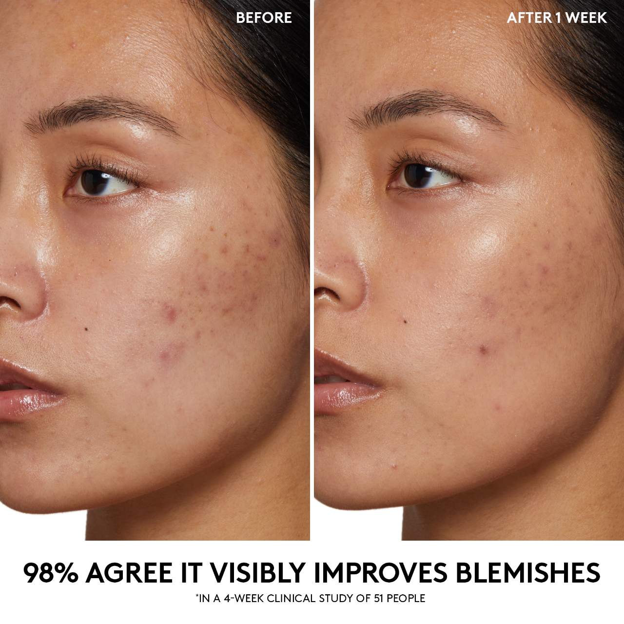 s2828648-av-2-zoom.jpg?imwidth=315