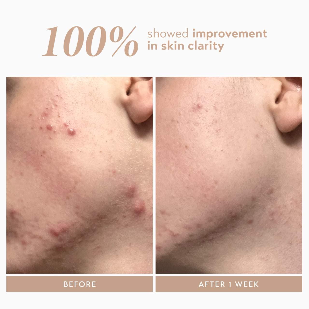 Сыворотка с 10% азелаинового комплекса от пигментных пятен Shani Darden Skin Care Rescue — фото 3